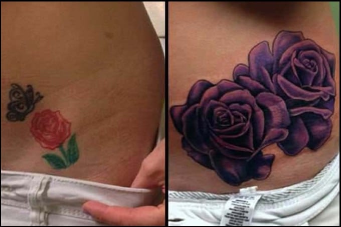 best tummy tuck cover up tattoos 